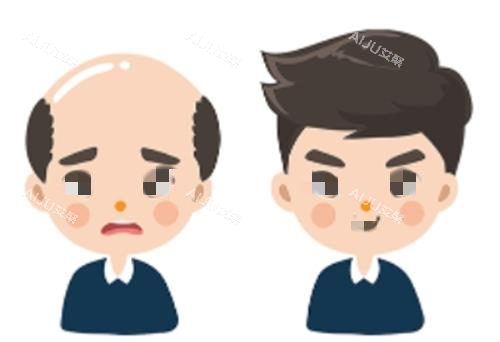 植发前后对比示意图