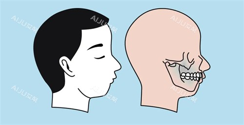凸嘴的图片