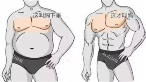 男性胸部对比