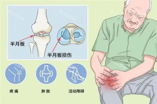 半月板损伤漫画示意图