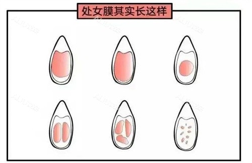 处女膜动画演示图