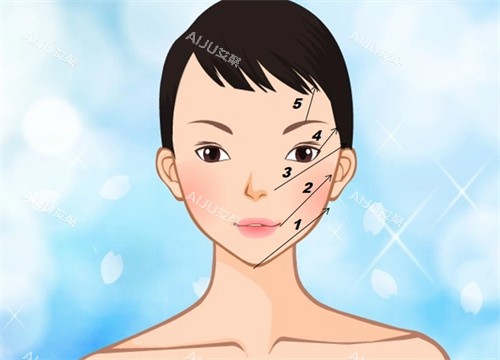 线提升