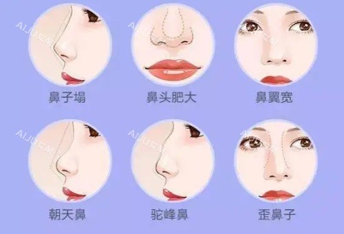 问题鼻型图片