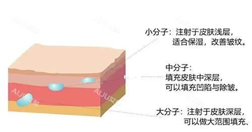 珀利肤宝宝针注射层次