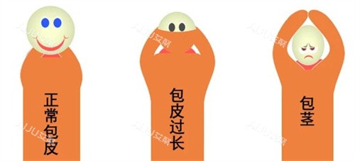 包皮过长、包茎、正常
