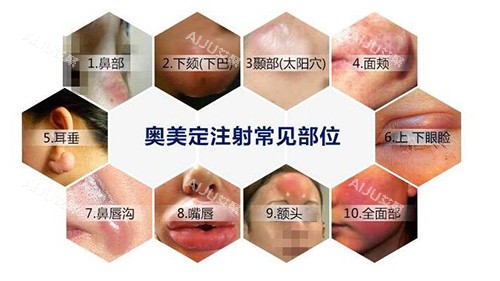 奥美定注射危害有哪些