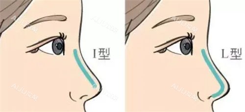 隆鼻不同形态假体呈现图