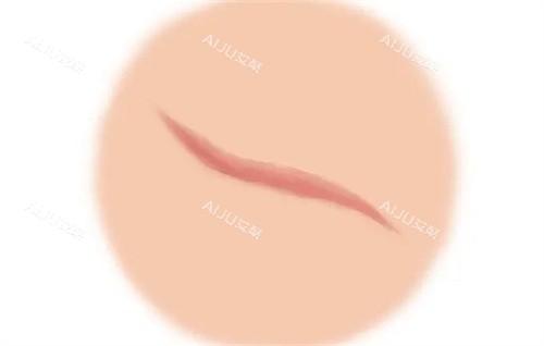 杨东运在重庆东上整形疤痕科，擅长瘢痕治疗，预约方便，口碑优良