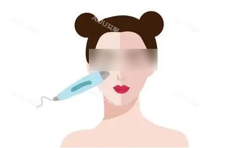 光子嫩肤流程图