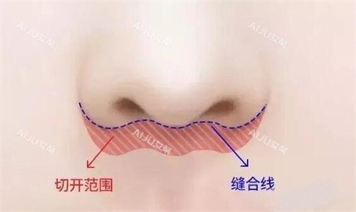 北京王晓健人中缩短卡通图展示