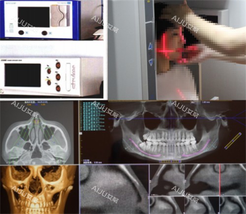 杭州连天美整形高俊明磨骨术前检查 杭州连天美整形高俊明磨骨术前检查