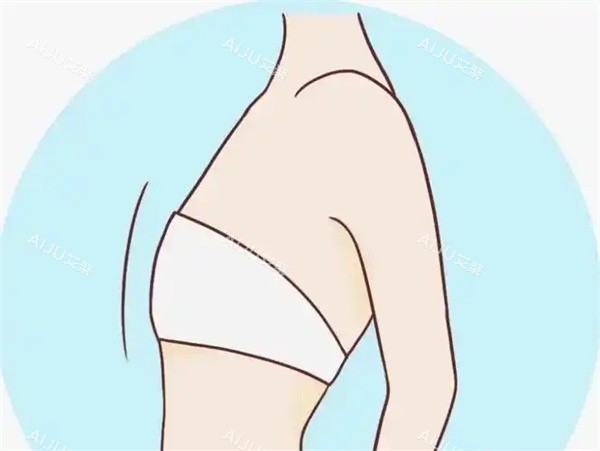 西安李高峰胸部缩小术