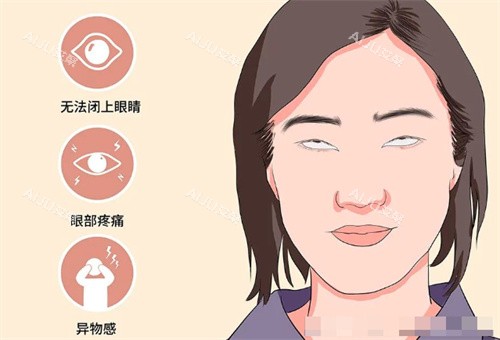 北京魏志香需要做眼修复的情况