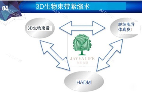 北京张海淋3d生物束带紧缩术讲解示意图