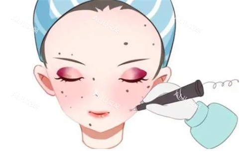 激光去痣卡通
