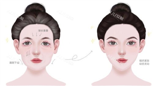 幼态脸前后紧致度对比
