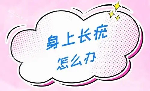 身体长疣怎么办