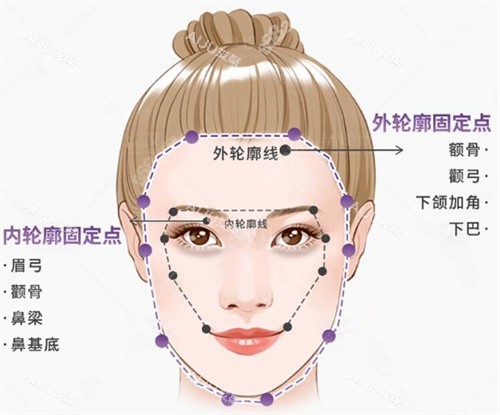沈阳李洁琪医生轮廓固定图示