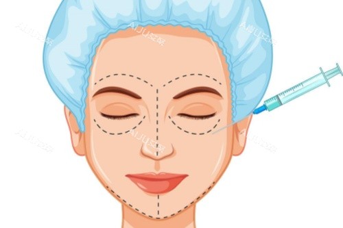 合肥张李娜面部注射卡通图片展示 合肥张李娜面部注射卡通图片展示