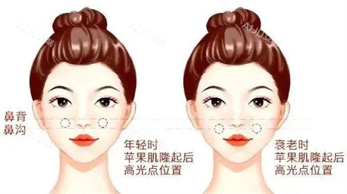 陈耀文幼态脸面部平整度高