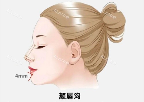 颏唇沟