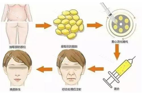 面部填充步骤图