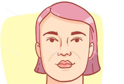 法令纹图片