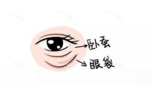 卧蚕、眼袋区别图