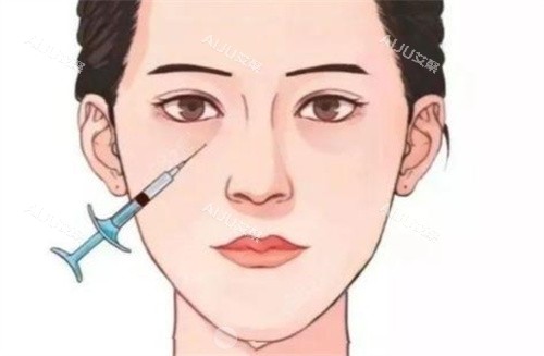 泪沟注射