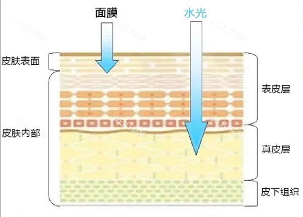 水光注射