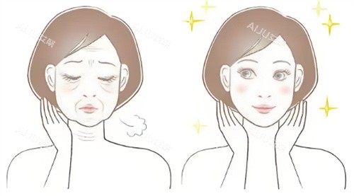 脸部抗衰前后对比