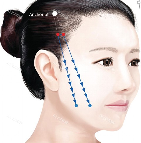 面部线提升卡通图