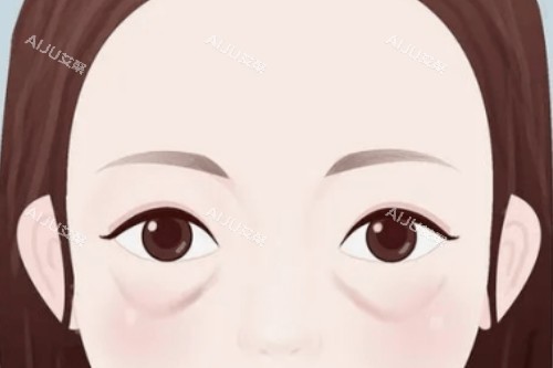 眼袋卡通展示图