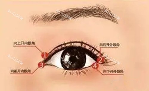 开内外眼角.webp