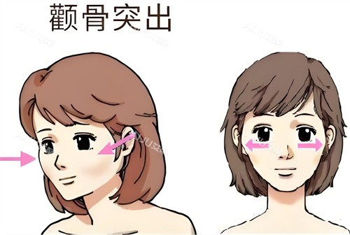 有牙套脸别慌！教你几招轻松改善，还你美丽面容