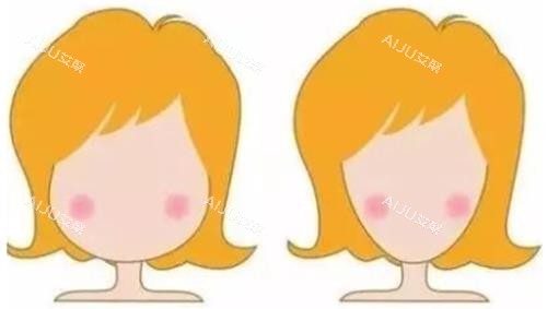 打针瘦脸明显对比图