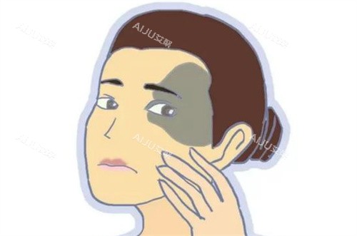 太田痣