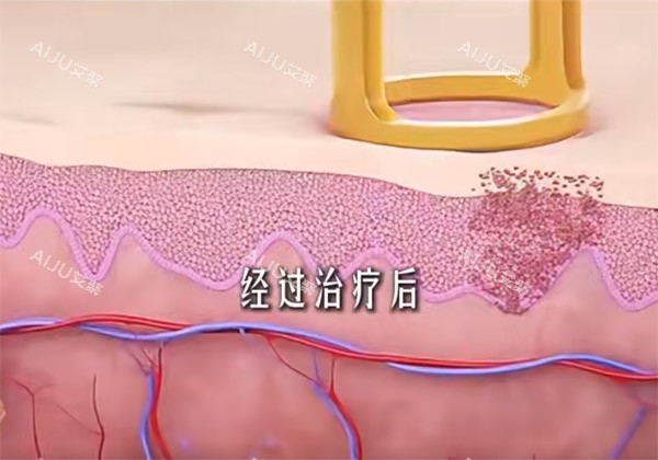 调Q激光原理细节图
