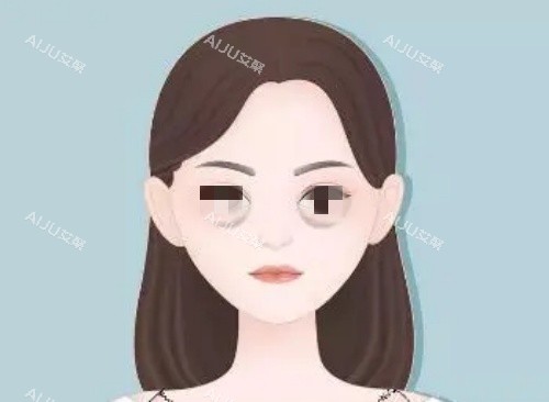 泪沟漫画示意图