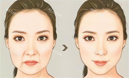 儒白天使面部抗衰对比