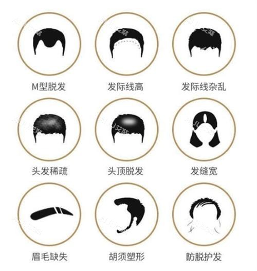 各种需要植发的情况图