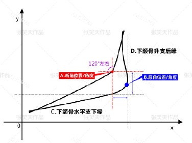 北京圣嘉新医疗美容医院张笑天下颌角手术设计