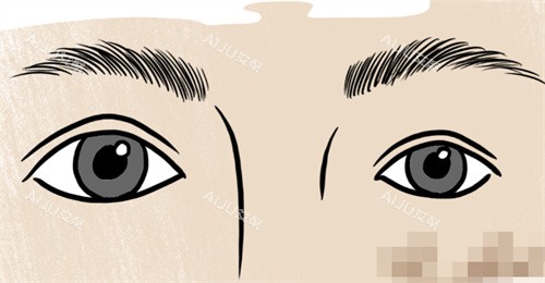 双眼皮大小眼修复 双眼皮大小眼修复
