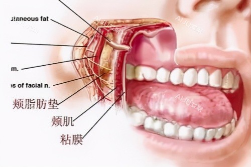 颊脂垫图片一览