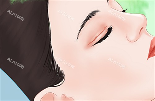 郑小红需要双眼皮修复的眼睛