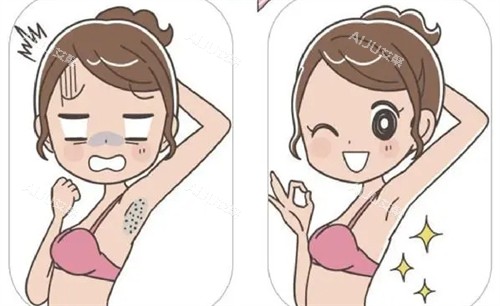 激光脱腋毛 激光脱腋毛